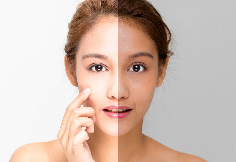 Kojic Acid Dipalmitate vs. Kojic Acid: What are the differences?